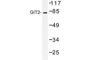 Image no. 1 for anti-G Protein-Coupled Receptor Kinase Interactor 2 (GIT2) antibody (ABIN272229) (GIT2 anticorps)