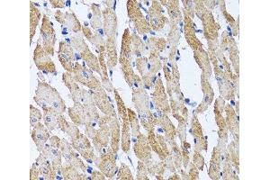 Immunohistochemistry of paraffin-embedded Mouse heart using ATP5B Polyclonal Antibody at dilution of 1:100 (40x lens).
