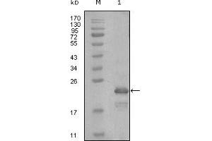 Western blot analysis using HAND1 mouse mAb against truncated Trx-HAND1 recombinant protein (1). (HAND1 anticorps)