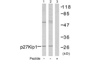 Image no. 2 for anti-Cyclin-Dependent Kinase Inhibitor 1B (p27, Kip1) (CDKN1B) (Ser10) antibody (ABIN197350)