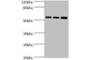 Western blot All lanes: Acyl-coenzyme A synthetase ACSM3, mitochondrial antibody at 10 μg/mL Lane 1: 293T whole cell lysate Lane 2: Mouse kidney tissue Lane 3: A431 whole cell lysate Secondary Goat polyclonal to rabbit IgG at 1/10000 dilution Predicted band size: 67, 50 kDa Observed band size: 67 kDa