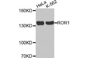 Western blot analysis of extracts of various cell lines, using ROR1 antibody. (ROR1 anticorps  (AA 30-200))