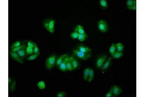 Immunofluorescence staining of HepG2 cells with ABIN7175545 at 1:66, counter-stained with DAPI. (PROS1 anticorps  (AA 42-676))