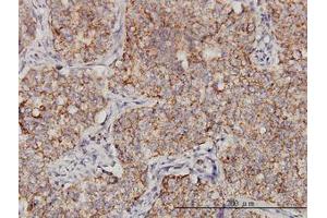 Image no. 1 for anti-Protoporphyrinogen Oxidase (PPOX) (AA 378-478) antibody (ABIN598883) (PPOX anticorps  (AA 378-478))