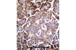AQP12B Antibody (C-term) immunohistochemistry analysis in formalin fixed and paraffin embedded human pancreas tissue followed by peroxidase conjugation of the secondary antibody and DAB staining. (Aquaporin 12B anticorps  (C-Term))