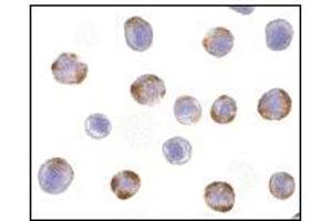 Image no. 3 for anti-Nucleotide-Binding Oligomerization Domain Containing 2 (NOD2) (C-Term) antibody (ABIN372922) (NOD2 anticorps  (C-Term))