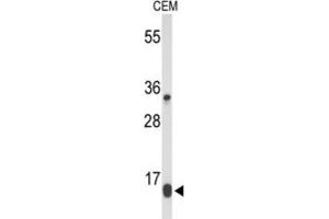 Western Blotting (WB) image for anti-DIRAS Family, GTP-Binding RAS-Like 1 (DIRAS1) antibody (ABIN5024693) (DIRAS1 anticorps)