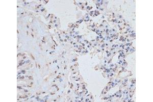 Immunohistochemistry of paraffin-embedded Rat lung using Phospho-MAPK3(Y204) Polyclonal Antibody at dilution of 1:100 (40x lens). (ERK1 anticorps  (pTyr204))