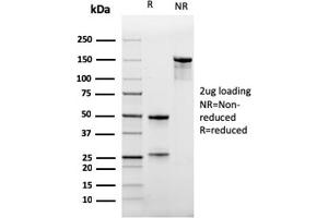SDS-PAGE Analysis Purified CD47 Mouse Monoclonal Antibody (IAP/964). (CD47 anticorps)