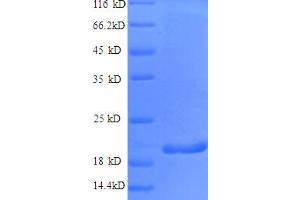 SDS-PAGE (SDS) image for Interferon gamma (IFNG) (AA 24-162), (partial) protein (His tag) (ABIN5712482)