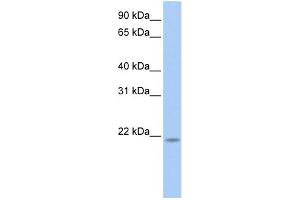 WB Suggested Anti-RNF5 Antibody Titration: 0.