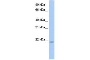 WB Suggested Anti-RNF5 Antibody Titration: 0. (RNF5 anticorps  (N-Term))
