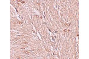 Immunohistochemistry (IHC) image for anti-Zinc Finger and BTB Domain Containing 4 (ZBTB4) (C-Term) antibody (ABIN1030812) (ZBTB4 anticorps  (C-Term))