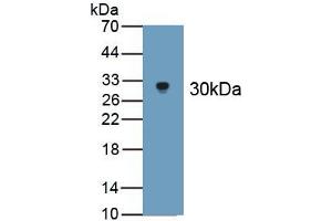 Detection of Recombinant APOB100, Cattle using Polyclonal Antibody to Apolipoprotein B100 (APOB100) (Apo-B100 anticorps  (AA 4331-4567))