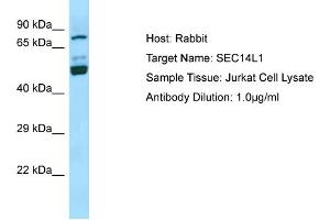 Western Blotting (WB) image for anti-SEC14-Like 1 (SEC14L1) (N-Term) antibody (ABIN2790166) (SEC14L1 anticorps  (N-Term))