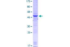 Image no. 1 for Ribonucleotide Reductase M1 (RRM1) (AA 593-792) protein (GST tag) (ABIN1318900)