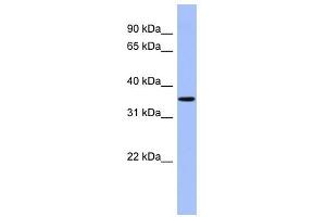 PPM1A antibody used at 1 ug/ml to detect target protein. (PPM1A anticorps)