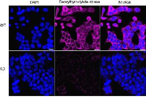 anti-Deoxythymidylate Kinase (Thymidylate Kinase) (DTYMK) antibody