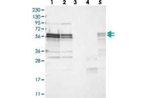 Western blot analysis of Lane 1: RT-4, Lane 2: U-251 MG, Lane 3: Human Plasma, Lane 4: Liver, Lane 5: Tonsil with ZC3H15 polyclonal antibody  at 1:250-1:500 dilution. (ZC3H15 anticorps)