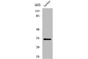 Western Blot analysis of Jurkat cells using UCP3 Polyclonal Antibody (UCP3 anticorps  (C-Term))