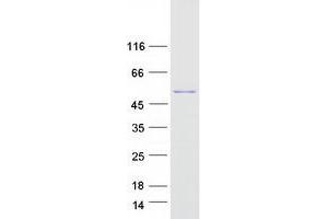 Validation with Western Blot