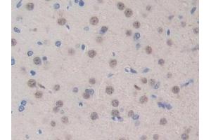 Detection of BMP15 in Rat Brain Tissue using Polyclonal Antibody to Bone Morphogenetic Protein 15 (BMP15)