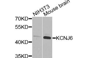 Western blot analysis of extracts of NIH3T3 and mouse brain cells, using KCNJ6 antibody. (KCNJ6 anticorps)