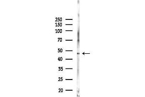 anti-6-phosphofructo-2-Kinase/fructose-2,6-Biphosphatase 1 (PFKFB1) (C-Term) antibody