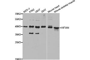 Western blot analysis of extracts of various cell lines, using HIF1AN antibody (ABIN5973179) at 1/1000 dilution. (HIF1AN anticorps)