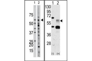 Image no. 1 for anti-Activin Receptor Type I (ACRV1) (Middle Region) antibody (ABIN360123)