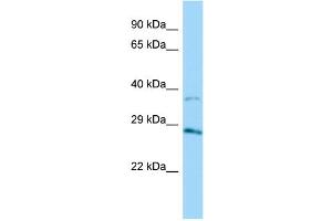 Host: Rabbit Target Name: AKR1B15 Sample Type: HT1080 Whole Cell lysates Antibody Dilution: 1. (AKR1B15 anticorps  (C-Term))