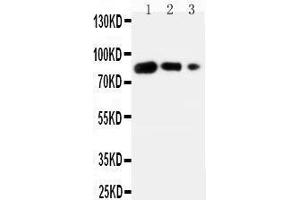 Western Blotting (WB) image for anti-CD80 (CD80) (AA 57-71), (N-Term) antibody (ABIN3042612) (CD80 anticorps  (N-Term))