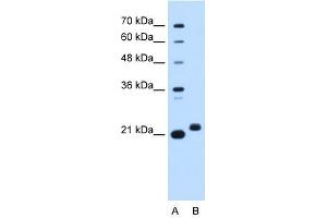 C1ORF159 antibody used at 0. (C1orf159 anticorps  (Middle Region))