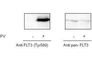 A431 cells were treated or untreated with Pervanadate. (FLT3 Kit ELISA)