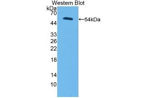 Detection of Recombinant PC, Human using Polyclonal Antibody to Pyruvate Carboxylase (PC) (PC anticorps  (AA 36-486))