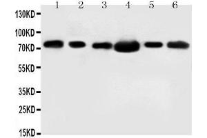 Anti-FAF1 antibody, Western blotting Lane 1: Rat Testis Tissue Lysate Lane 2: MM453 Cell Lysate Lane 3: MM231 Cell Lysate Lane 4: HELA Cell Lysate Lane 5: SMMC Cell Lysate Lane 6: SW620 Cell Lysate (FAF1 anticorps  (N-Term))