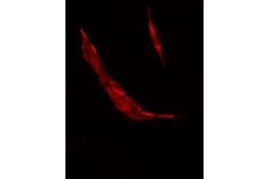 ABIN6278637 staining COLO205 by IF/ICC. (TAAR3 anticorps)