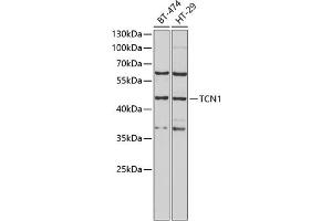 Western blot analysis of extracts of various cell lines, using TCN1 antibody (ABIN6132752, ABIN6148950, ABIN6148951 and ABIN6222050) at 1:1000 dilution. (TCN1 anticorps  (AA 24-280))