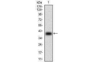 Fig. (TCL1A anticorps  (AA 10-104))