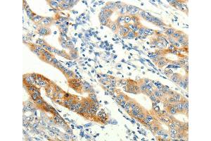 Immunohistochemistry (IHC) image for anti-Transient Receptor Potential Cation Channel, Subfamily A, Member 1 (TRPA1) antibody (ABIN2432369) (TRPA1 anticorps)