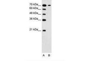 Image no. 1 for anti-Solute Carrier Family 5 (Low Affinity Glucose Cotransporter), Member 4 (SLC5A4) (N-Term) antibody (ABIN205017) (SLC5A4 anticorps  (N-Term))