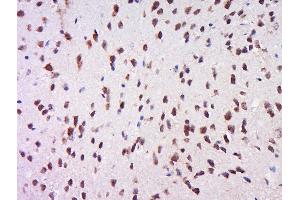 Paraformaldehyde-fixed, paraffin embedded rat brain, Antigen retrieval by boiling in sodium citrate buffer (pH6) for 15min, Block endogenous peroxidase by 3% hydrogen peroxide for 30 minutes, Blocking buffer (normal goat serum) at 37°C for 20min, Antibody incubation with Rabbit Anti-MSK1 (Ser212) Polyclonal Antibody, Unconjugated  at 1:500 overnight at 4°C, followed by a conjugated secondary for 90 minutes and DAB staining.