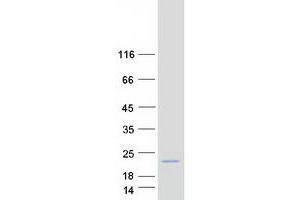 Validation with Western Blot (CNIH2 Protein (Myc-DYKDDDDK Tag))