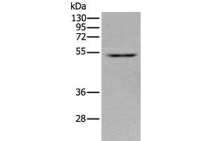 Western blot analysis of HEPG2 cell lysate using ZNF672 Polyclonal Antibody at dilution of 1:350 (ZNF672 anticorps)