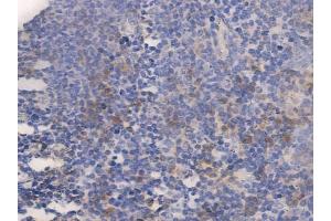 ABIN6256267 and ABIN6267293 at 1/100 staining human normal tonsil tissue by IHC-P.