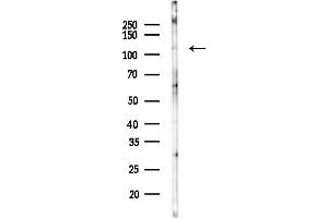 anti-Importin 5 (IPO5) antibody