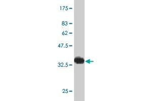 Western Blot detection against Immunogen (34. (HAND2 anticorps  (AA 135-216))