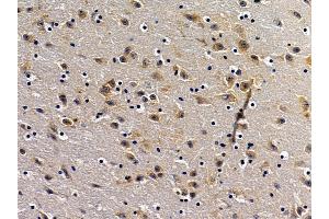 ABIN7094290 and ABIN7098337 at 1/100 staining mouse brain tissue by IHC-P. (HSPA13 anticorps  (C-Term))