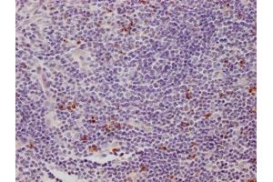 IHC image of ABIN7158617 diluted at 1:500 and staining in paraffin-embedded human appendix tissue performed on a Leica BondTM system.