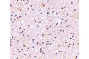 Immunohistochemical staining of human brain tissue with 5 ug/mL CADPS polyclonal antibody . (CADPS anticorps  (N-Term))